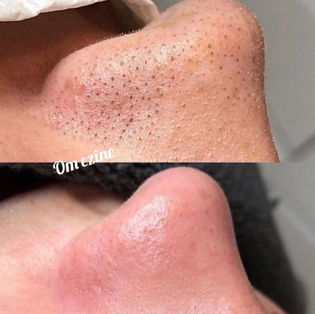 Pack Duo Skin Glow - Éclat Instantané pour Votre Peau